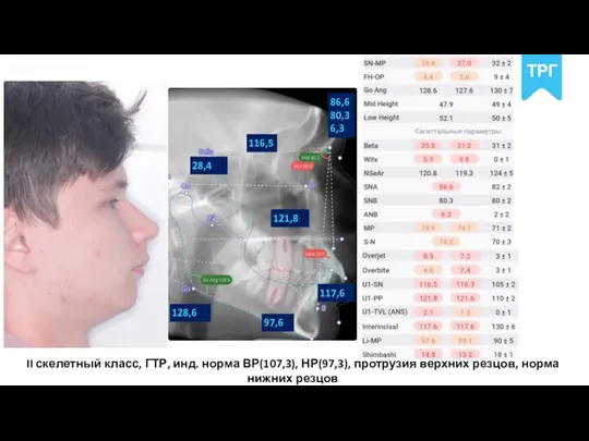 POLNYY PORYADOK 86,6 80,3 6,3 28,4 128,6 117,6 97,6 116,5