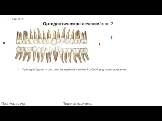 Пациент: Ортодонтическое лечение/этап 2 Подпись врача: Подпись пациента: R L