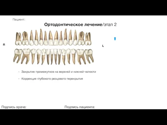 Пациент: Ортодонтическое лечение/этап 2 Подпись врача: Подпись пациента: R L