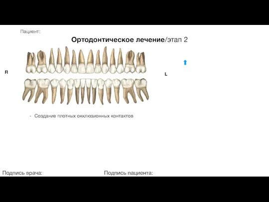 Пациент: Ортодонтическое лечение/этап 2 Подпись врача: Подпись пациента: R L Создание плотных окклюзионных контактов