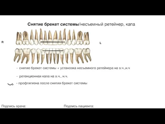 Снятие брекет системы/несъемный ретейнер, капа Подпись врача: Подпись пациента: R