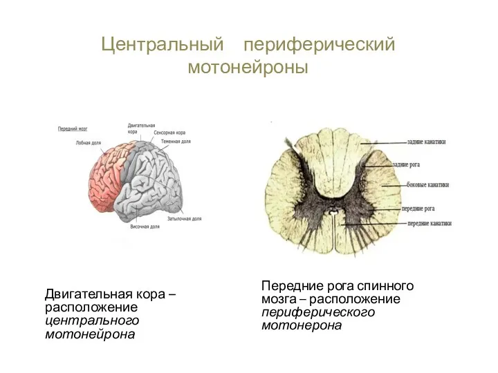 Центральный и периферический мотонейроны Передние рога спинного мозга – расположение