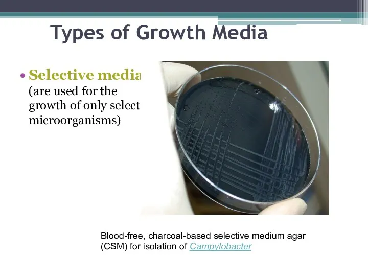 Types of Growth Media Selective media (are used for the