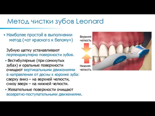 Метод чистки зубов Leonard Наиболее простой в выполнении метод («от красного к белому»)