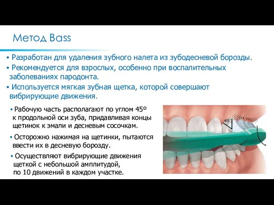 Метод Bass Разработан для удаления зубного налета из зубодесневой борозды. Рекомендуется для взрослых,