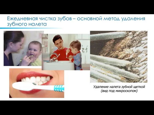 Ежедневная чистка зубов – основной метод удаления зубного налета Удаление налета зубной щеткой (вид под микроскопом)