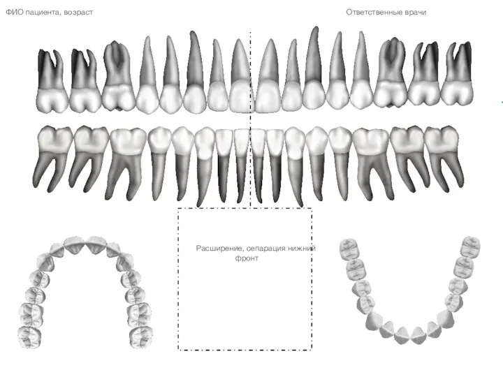 Расширение, сепарация нижний фронт Ответственные врачи ФИО пациента, возраст 12