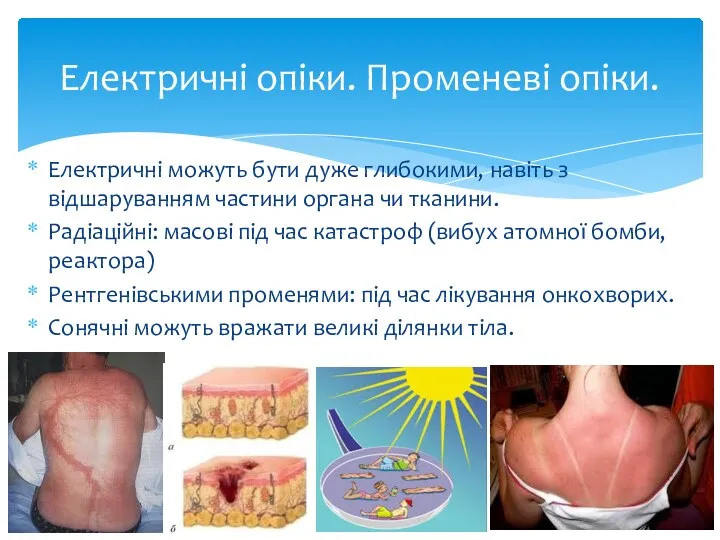 Електричні можуть бути дуже глибокими, навіть з відшаруванням частини органа