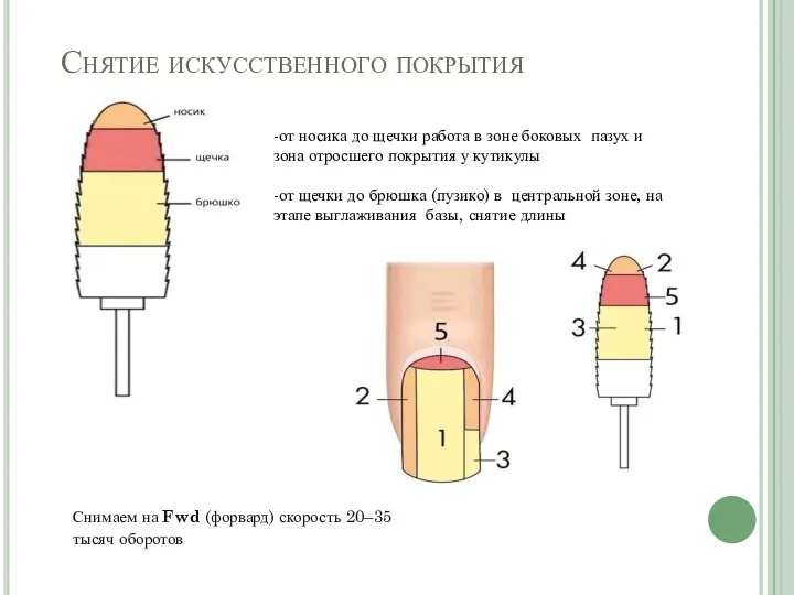 Снятие искусственного покрытия -от носика до щечки работа в зоне