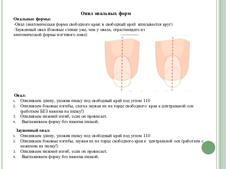 Опил овальных форм Овальные формы: -Овал (анатомическая форма свободного края: