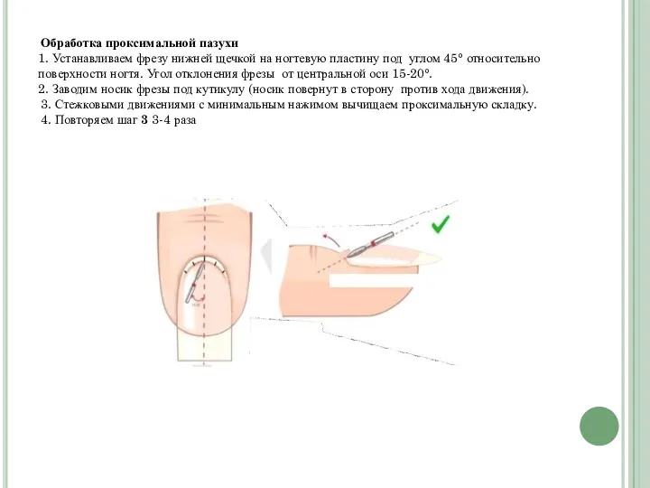 Обработка проксимальной пазухи 1. Устанавливаем фрезу нижней щечкой на ногтевую