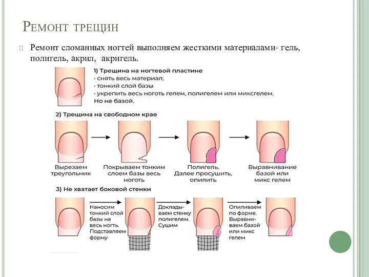 Ремонт трещин Ремонт сломанных ногтей выполняем жесткими материалами- гель, полигель, акрил, акригель.