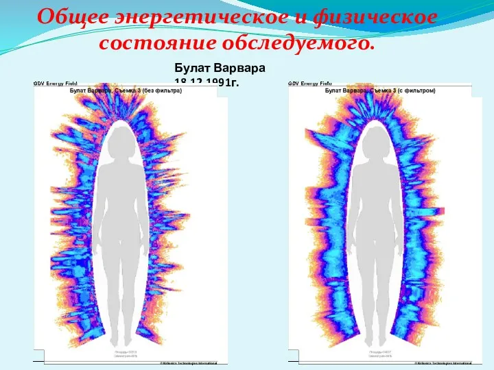 Общее энергетическое и физическое состояние обследуемого. Булат Варвара 18.12.1991г.