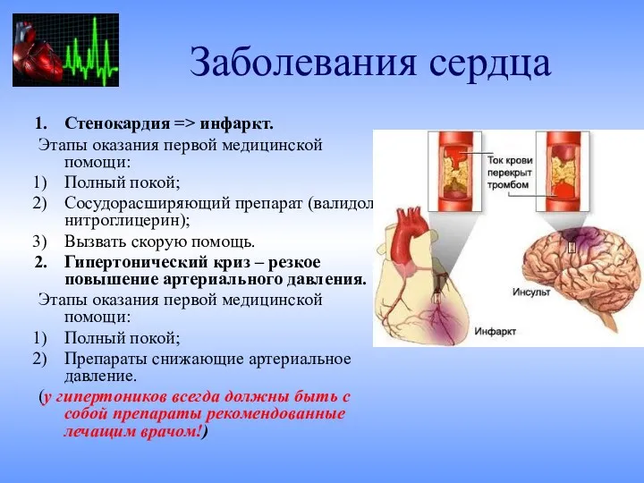 Заболевания сердца Стенокардия => инфаркт. Этапы оказания первой медицинской помощи: