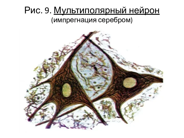 Рис. 9. Мультиполярный нейрон (импрегнация серебром)