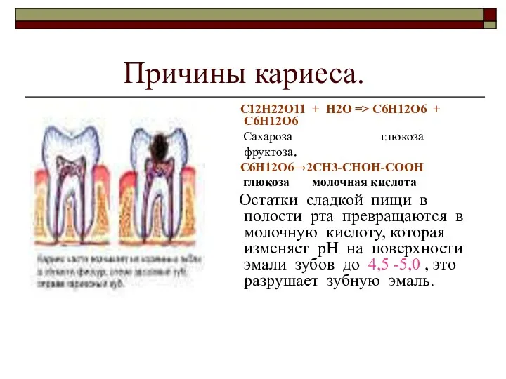 Причины кариеса. С12Н22О11 + Н2О => C6H12O6 + C6H12O6 Сахароза