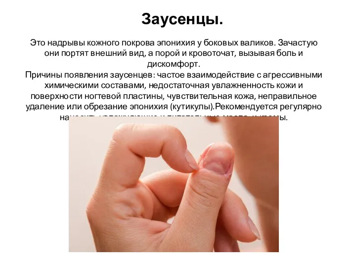 Заусенцы. Это надрывы кожного покрова эпонихия у боковых валиков. Зачастую