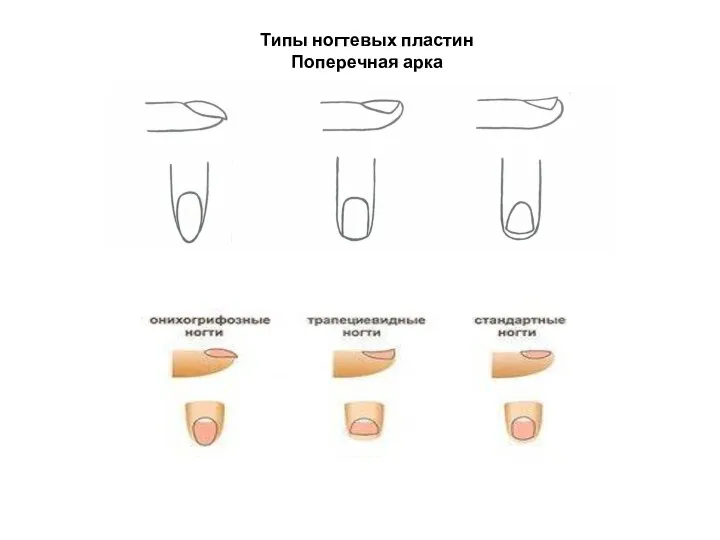 Типы ногтевых пластин Поперечная арка