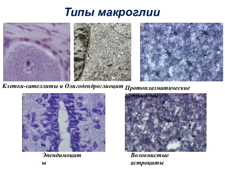 Типы макроглии Клетки-сателлиты и Олигодендроглиоцит Протоплазматические астроциты Волокнистые астроциты Эпендимоциты