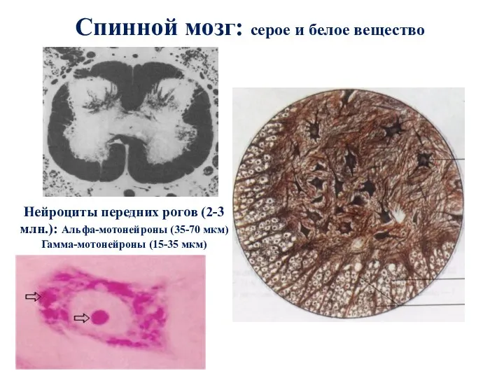 Нейроциты передних рогов (2-3 млн.): Альфа-мотонейроны (35-70 мкм) Гамма-мотонейроны (15-35