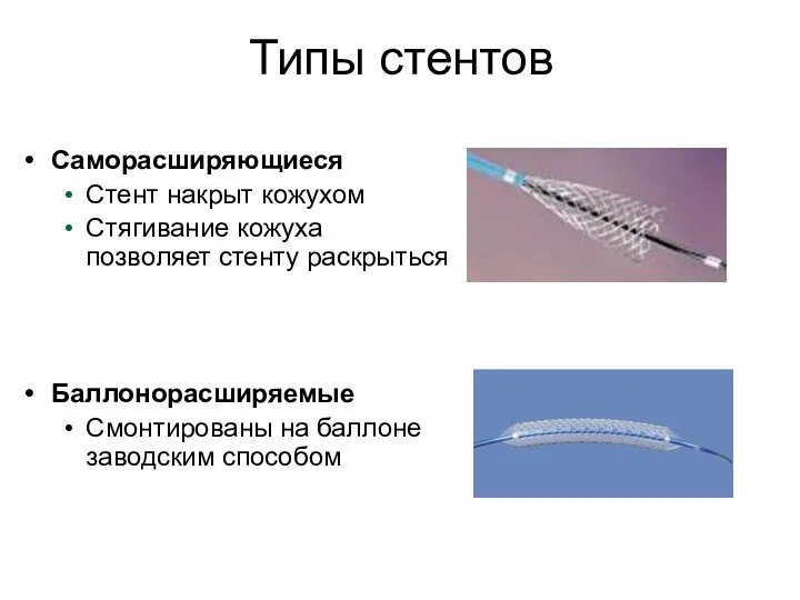 Саморасширяющиеся Стент накрыт кожухом Стягивание кожуха позволяет стенту раскрыться Баллонорасширяемые