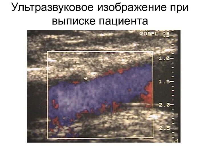 Ультразвуковое изображение при выписке пациента