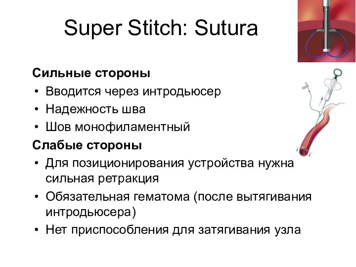 Super Stitch: Sutura Сильные стороны Вводится через интродьюсер Надежность шва
