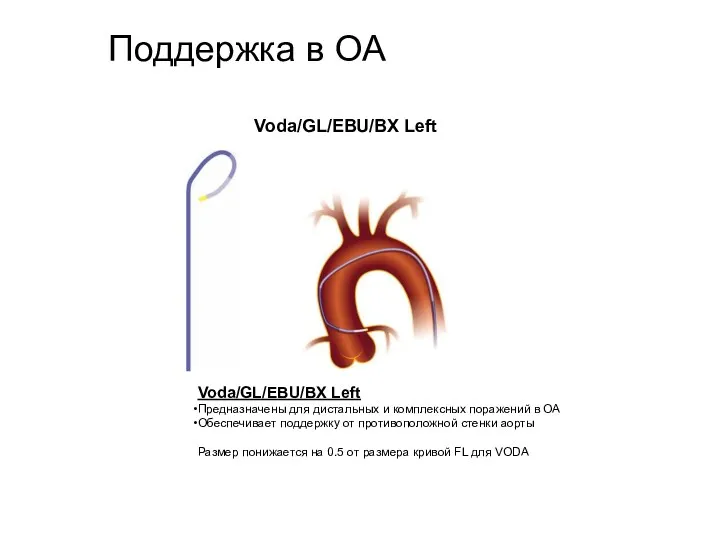 Поддержка в ОА Voda/GL/EBU/BX Left Voda/GL/EBU/BX Left Предназначены для дистальных