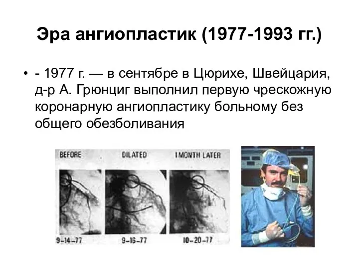 Эра ангиопластик (1977-1993 гг.) - 1977 г. — в сентябре