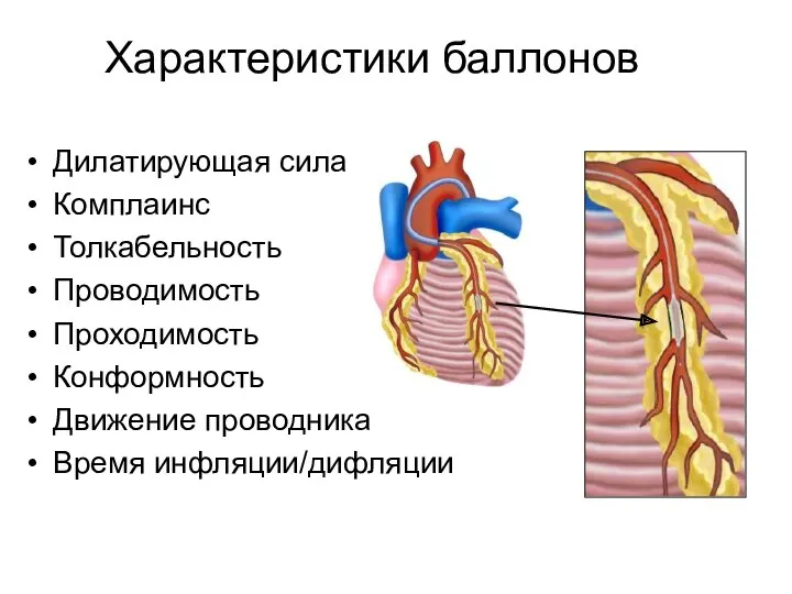 Характеристики баллонов Дилатирующая сила Комплаинс Толкабельность Проводимость Проходимость Конформность Движение проводника Время инфляции/дифляции