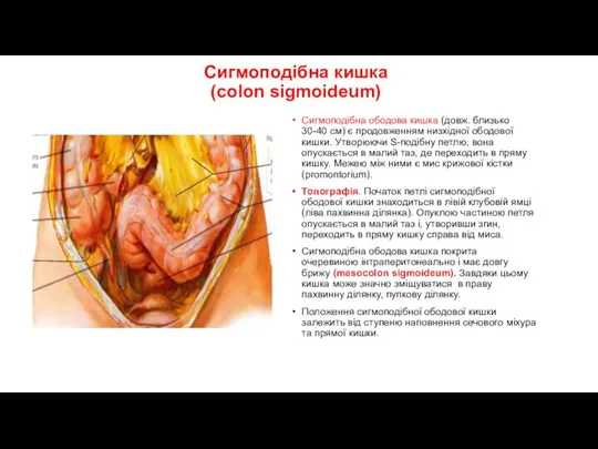 Сигмоподібна кишка (colon sigmoideum) Сигмоподібна ободова кишка (довж. близько 30-40 см) є продовженням