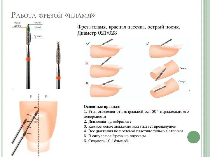 Работа фрезой «пламя» Фреза пламя, красная насечка, острый носик. Диаметр