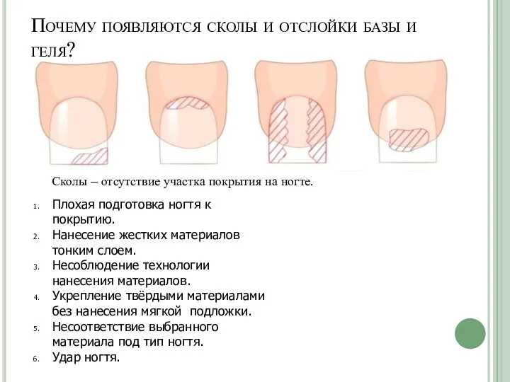 Почему появляются сколы и отслойки базы и геля? Сколы –