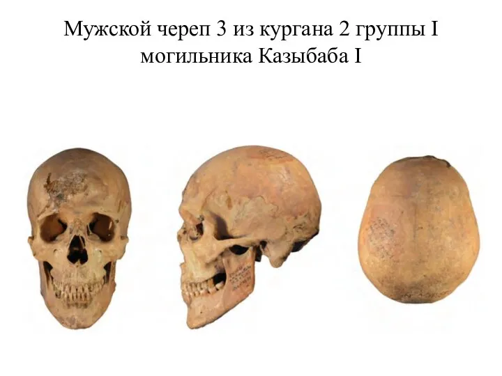 Мужской череп 3 из кургана 2 группы I могильника Казыбаба I