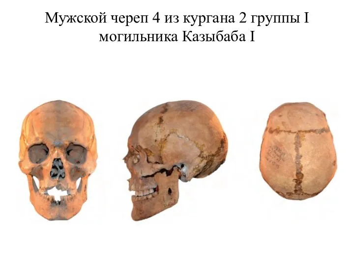 Мужской череп 4 из кургана 2 группы I могильника Казыбаба I