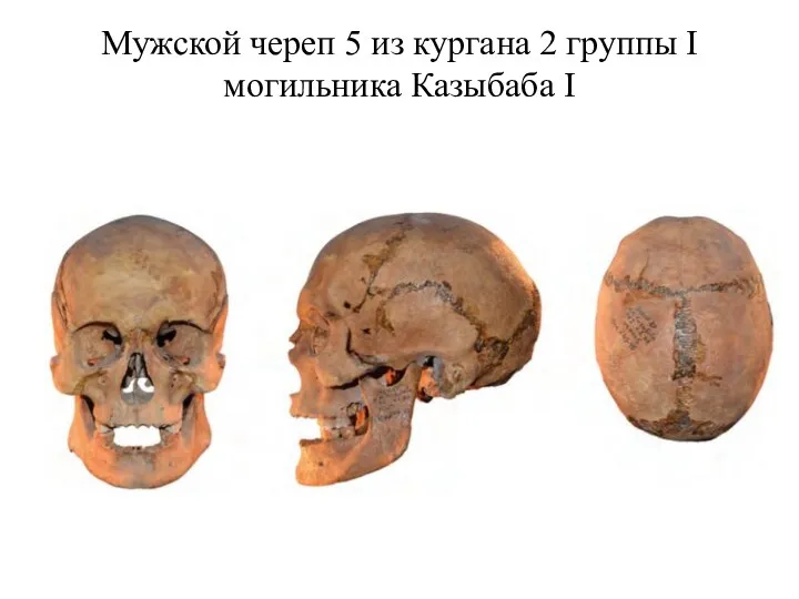 Мужской череп 5 из кургана 2 группы I могильника Казыбаба I