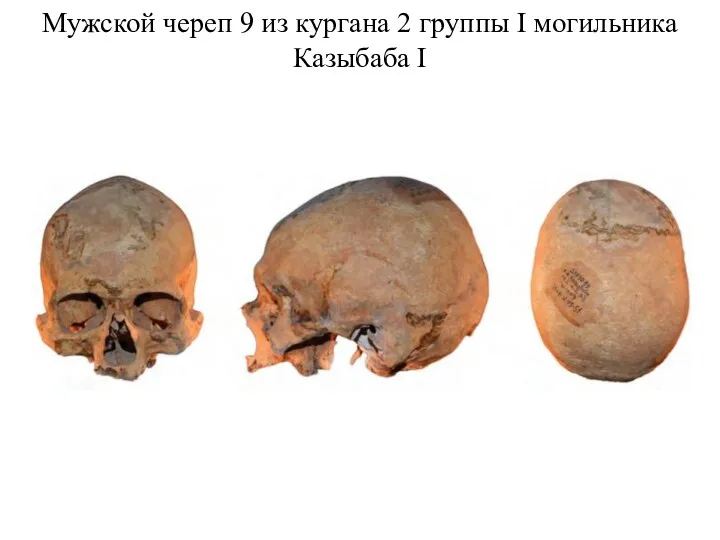 Мужской череп 9 из кургана 2 группы I могильника Казыбаба I