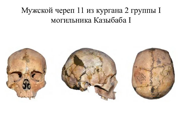 Мужской череп 11 из кургана 2 группы I могильника Казыбаба I