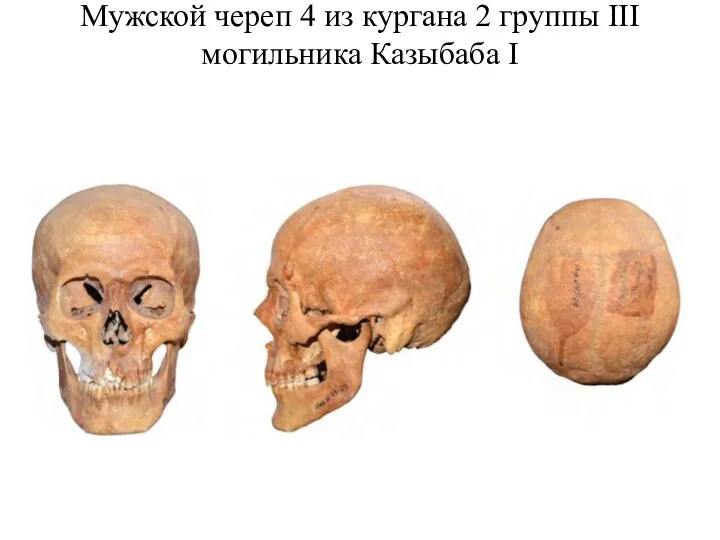 Мужской череп 4 из кургана 2 группы III могильника Казыбаба I
