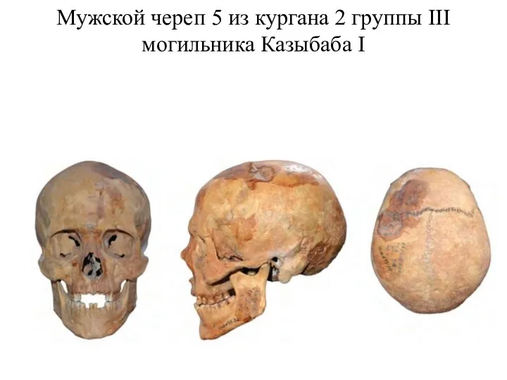 Мужской череп 5 из кургана 2 группы III могильника Казыбаба I