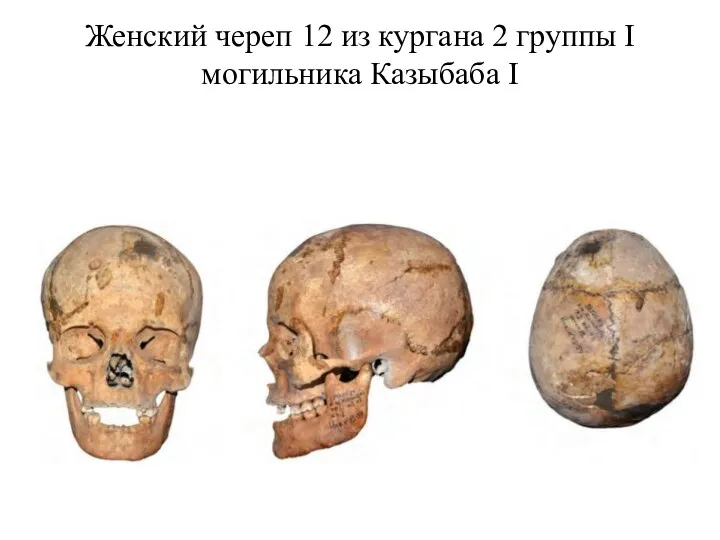 Женский череп 12 из кургана 2 группы I могильника Казыбаба I