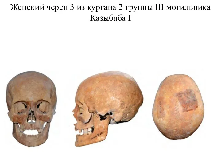 Женский череп 3 из кургана 2 группы III могильника Казыбаба I