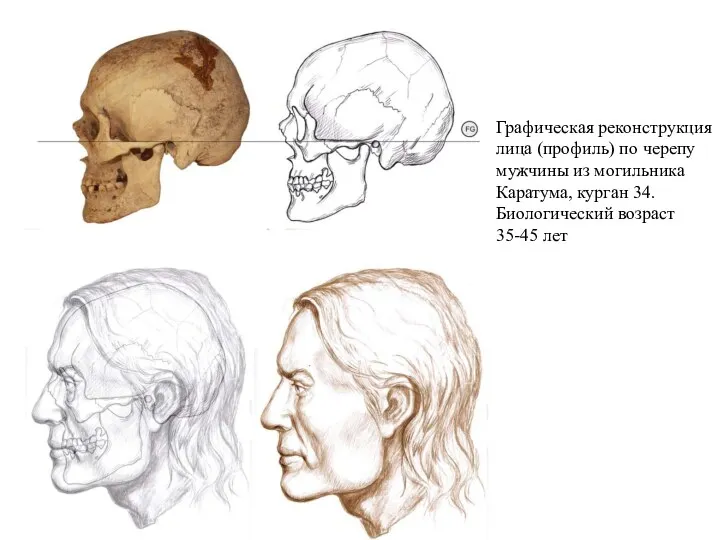Графическая реконструкция лица (профиль) по черепу мужчины из могильника Каратума, курган 34. Биологический возраст 35-45 лет