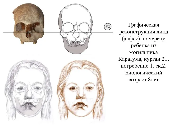 Графическая реконструкция лица (анфас) по черепу ребенка из могильника Каратума, курган 21, погребение