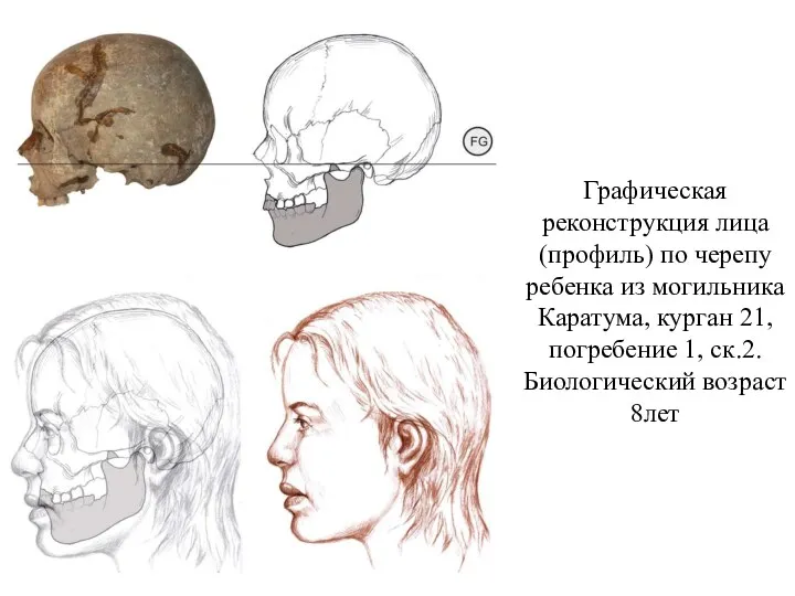 Графическая реконструкция лица (профиль) по черепу ребенка из могильника Каратума, курган 21, погребение
