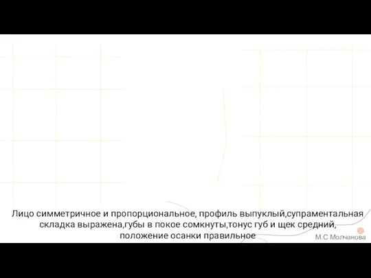 Лицо симметричное и пропорциональное, профиль выпуклый,супраментальная складка выражена,губы в покое сомкнуты,тонус губ и