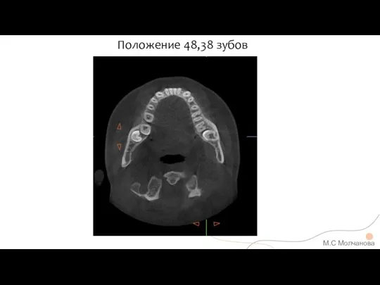 Положение 48,38 зубов М.С Молчанова