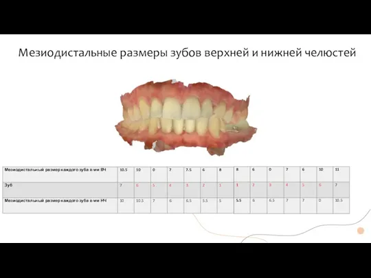Мезиодистальные размеры зубов верхней и нижней челюстей