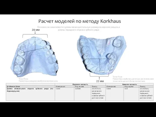 Расчет моделей по методу Korkhaus Точки Пона : Премоляры-середина межбугорковой фиссуры Точки Пона