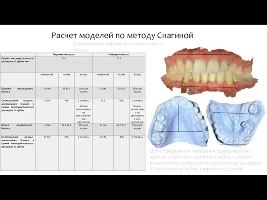Для определения показаний к расширению зубных рядов или удалению зубов с учетом взаимосвязи